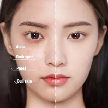 "Naisten Butterfly BB Kerma ilmatyyny, kompakti design, hengittävä tunne, täydellinen peittävyys aknelle ja tummille läiskill